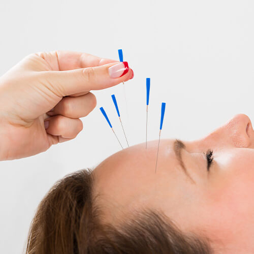 Behandlungsmethoden - Akupunktur nach Boel Komplettausbildung
